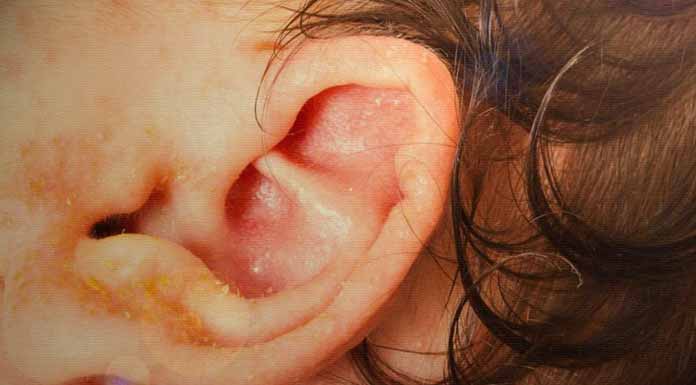Çocuklarda Dış Kulak İltihabının Belirtileri ve Tedavisi